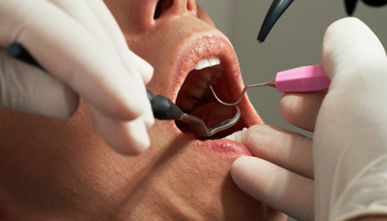 Case Study: Helping Dentists Open Wide — Express Medicals